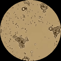 Microscopic oil sample before bypass filtration—heavy particle contamination visible